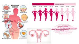 Ménopause-Ayurveda-femme
